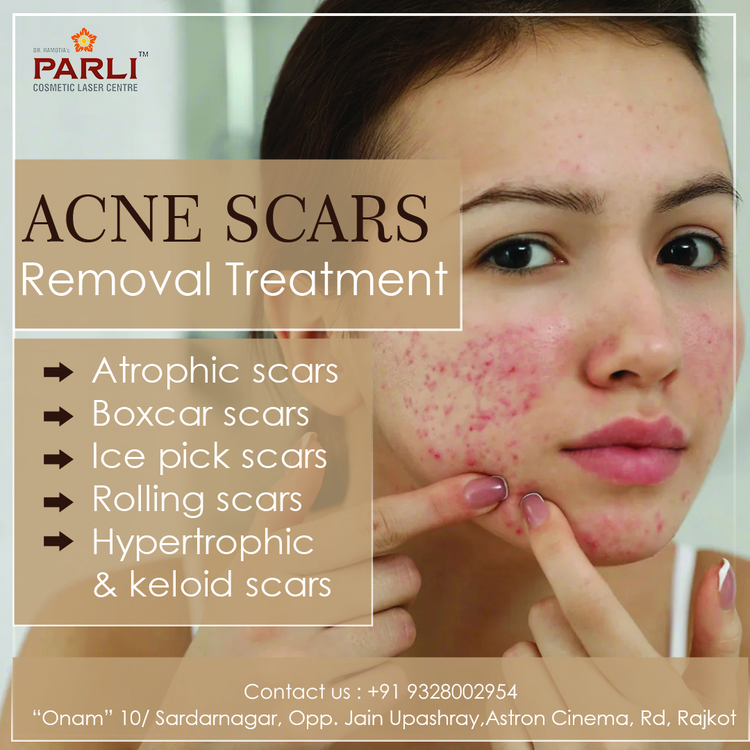 Acne Scar & Pimple Treatment