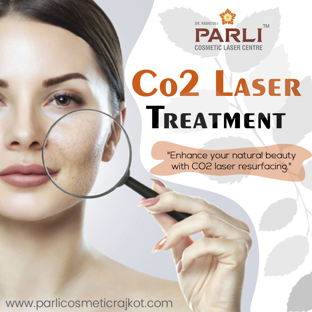 CO2 Laser Treatment