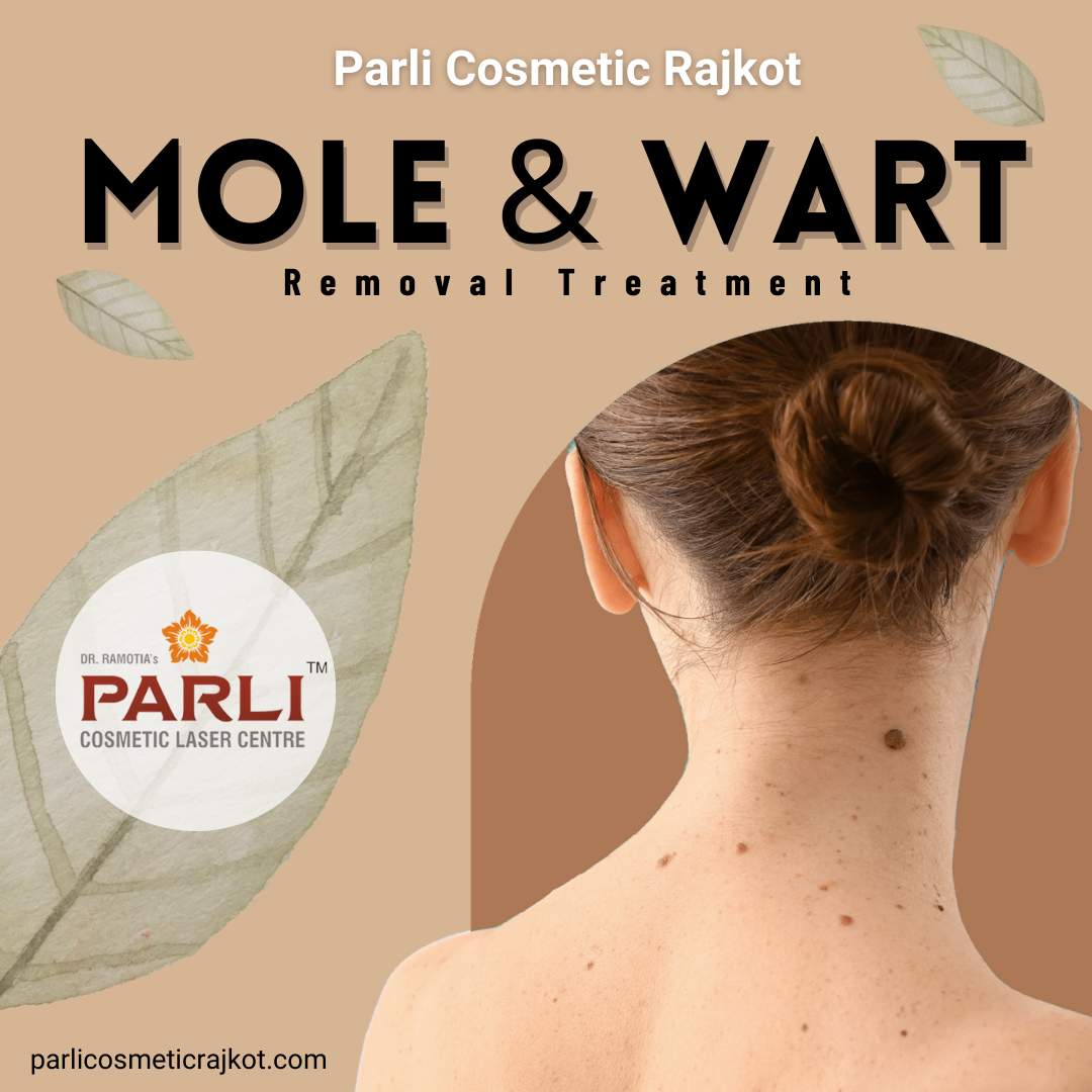 Mole And Wart Removal