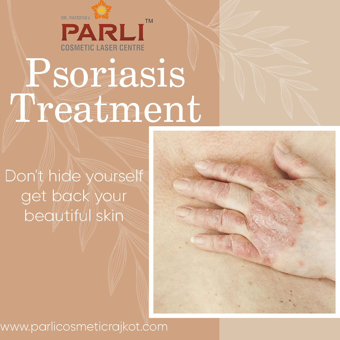 8 Types of Psoriasis: Photos, Symptoms, and More