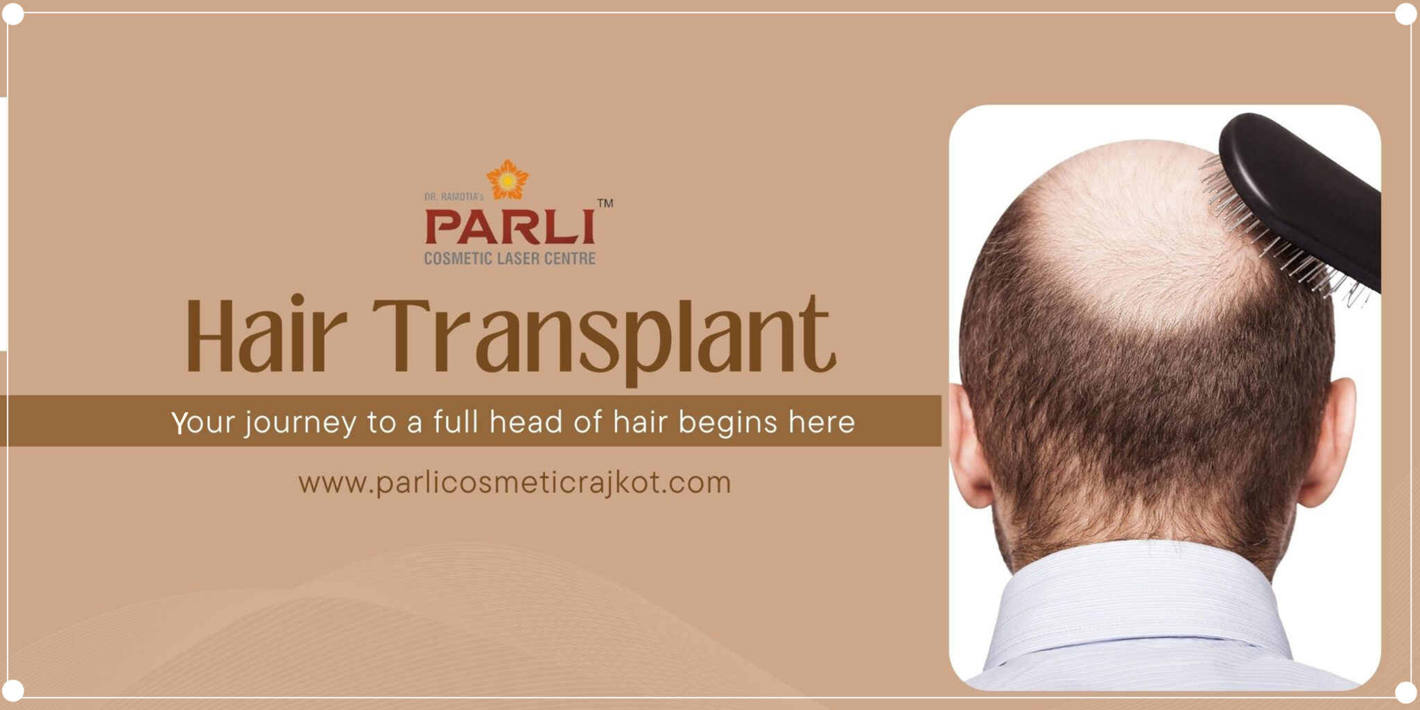 Hair Transplant in Rajkot PARLI Best Hair Transplant Clinic for Men