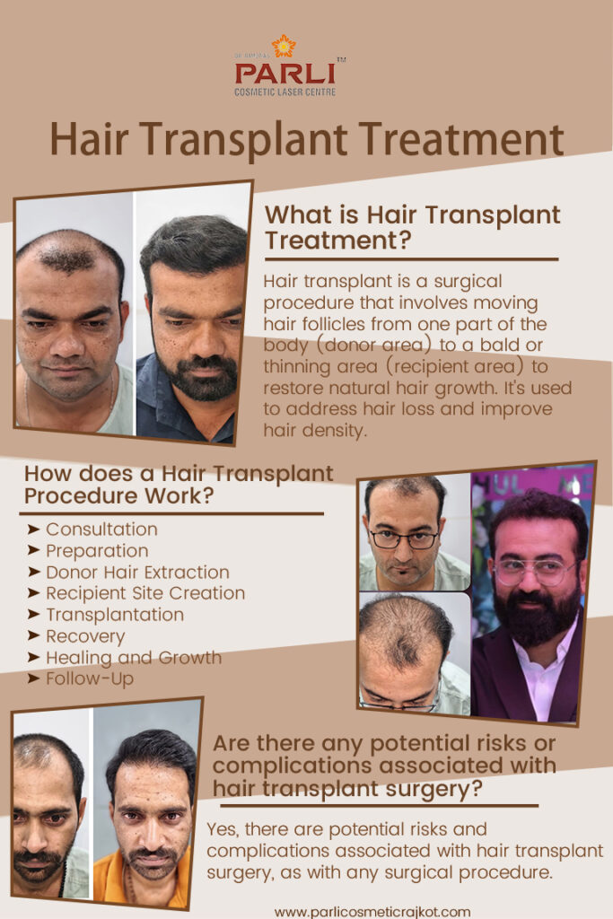 Hair Transplant Specialist in Rajkot