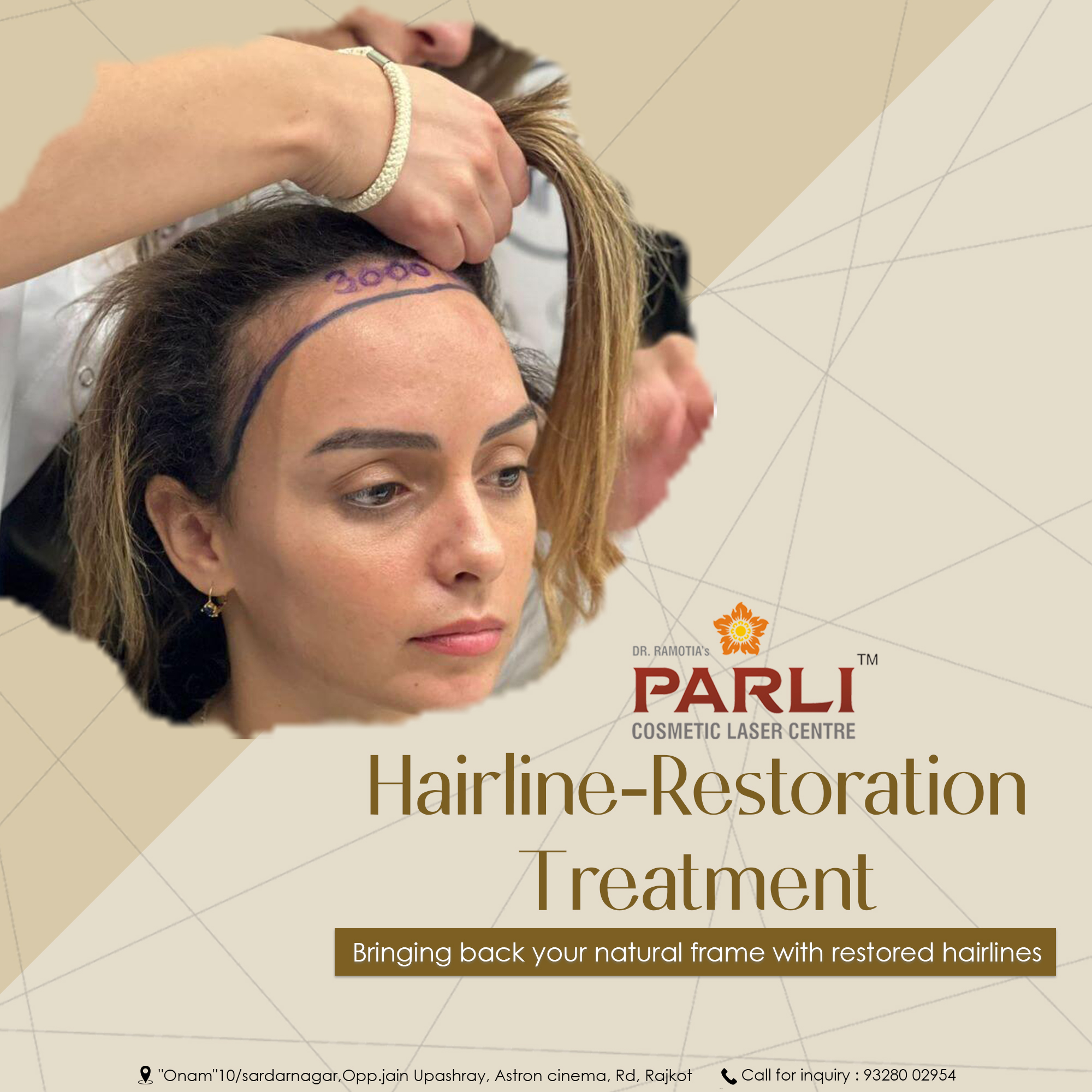 Hairline-Restoration-Treatment-in-Rajkot.jpg