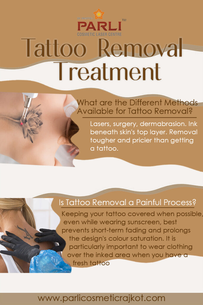 Tattoo Removal Laser Treatment in Rajkot
